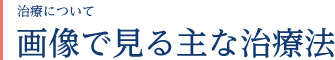 診療のご案内　画像で見る主な治療法