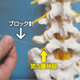 ブロック 神経 効き目 根 注射